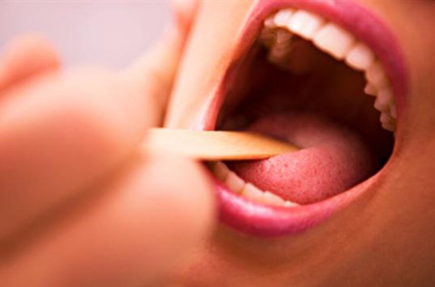 parazītu veidi cilvēka mutē